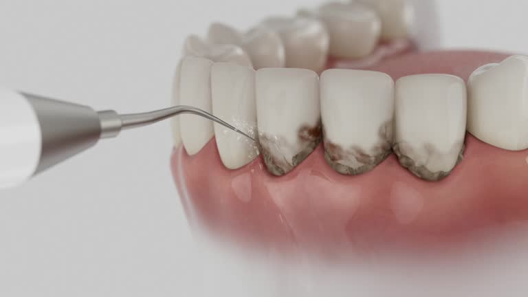 Trusted Teeth Cleaning And Checkup service in Uvalde Estates, TX - Dentist Open Now